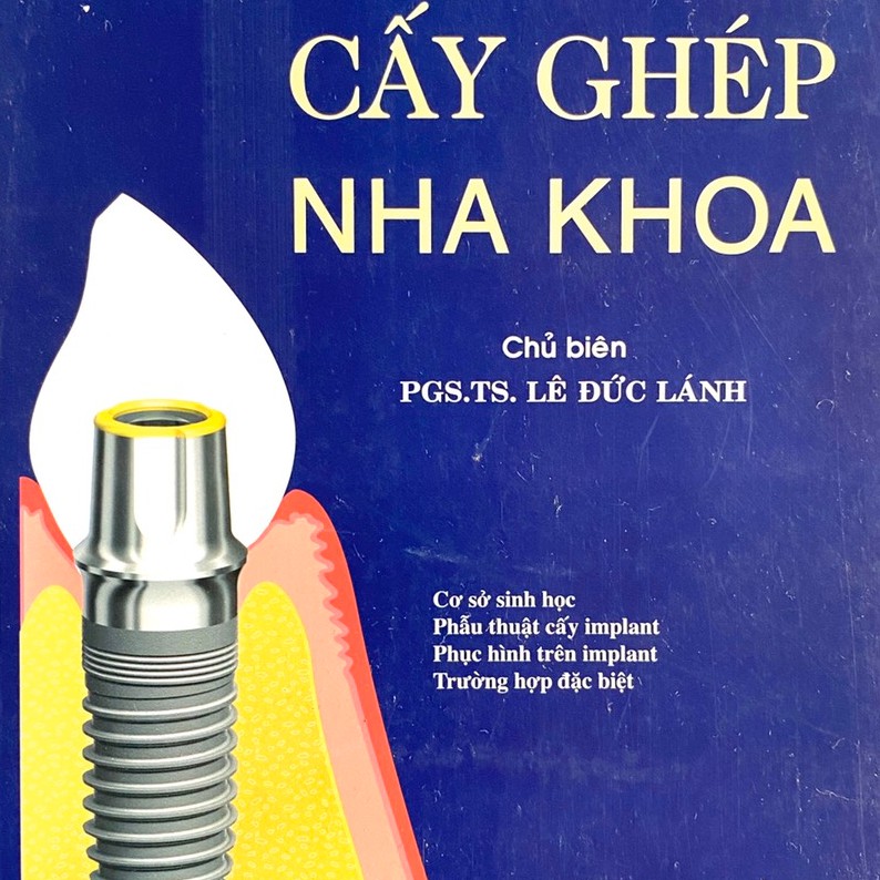 Sách - Cấy ghép nha khoa