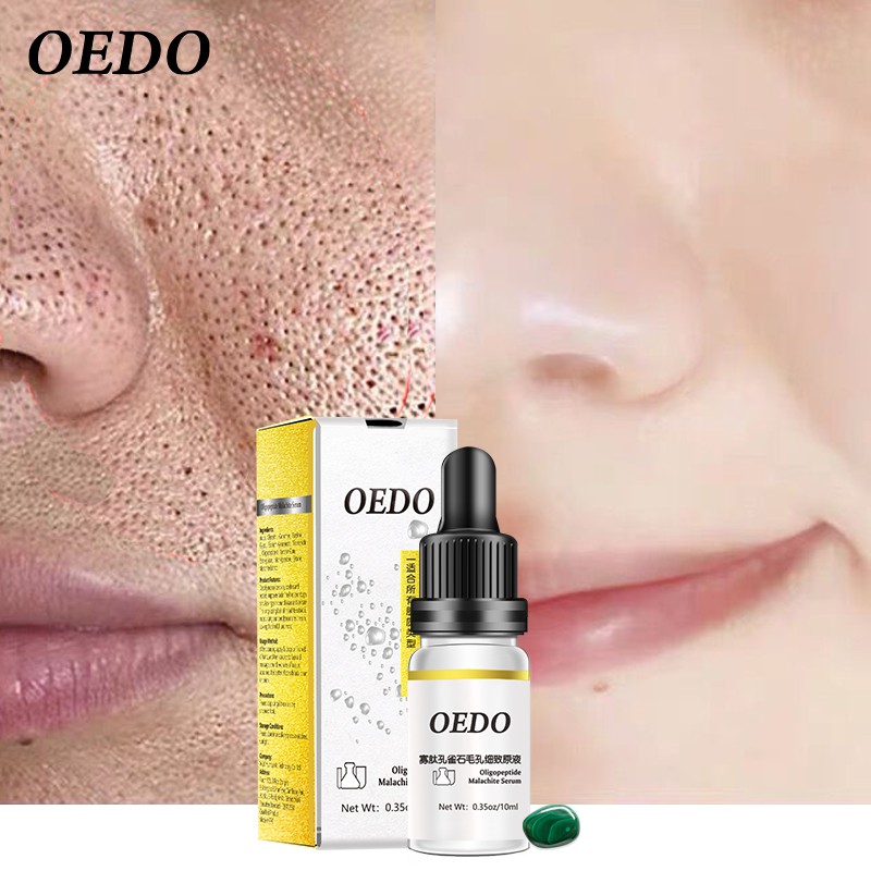 Serum OEDO Oligopeptide Malachite giảm vết nhăn chống lão hóa làm trắng da se khít lỗ chân lông dạng lỏng da mặt