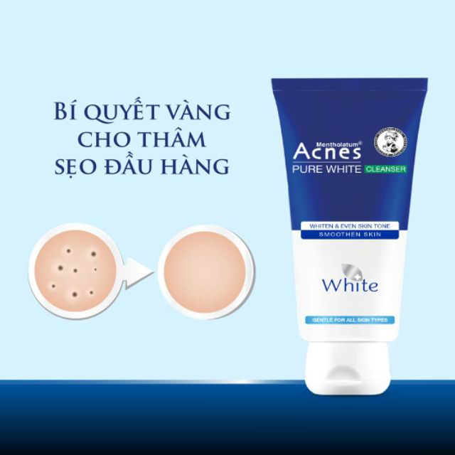 SỮA RỬA MẶT ACNES CHĂM SÓC DA SAU MỤN 25g