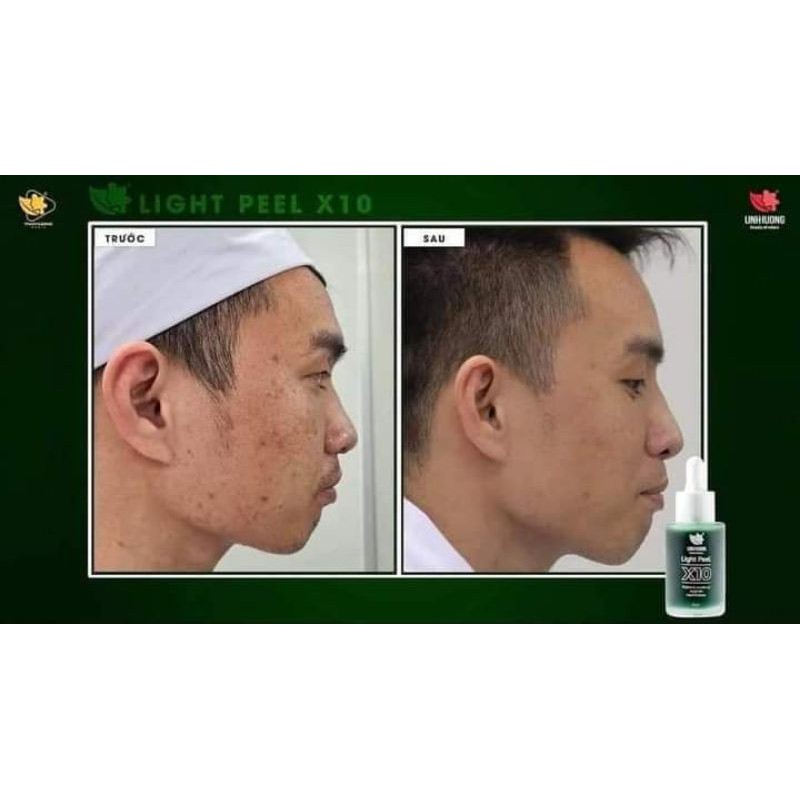 [CHÍNH HÃNG]PEEL DA AHA BHA MỜ NÁM, GIẢM MỤN, DƯỠNG TRẮNG, TRẺ HÓA DA | BigBuy360 - bigbuy360.vn