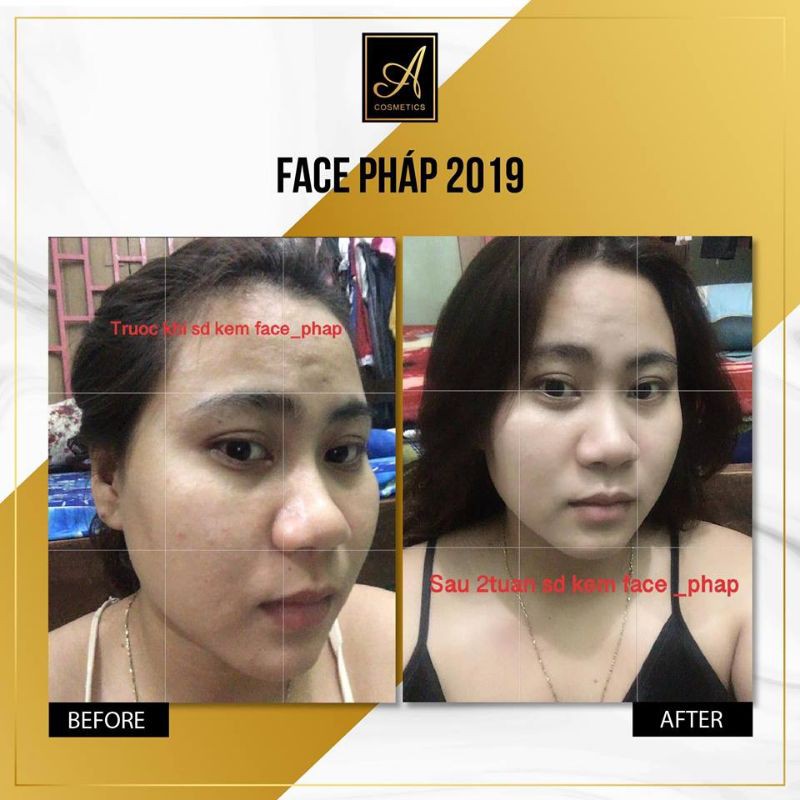KEM FACE A 150G | BigBuy360 - bigbuy360.vn