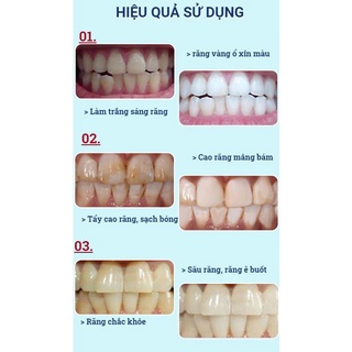 Kem Đánh Răng HUNMUI Siêu Hot