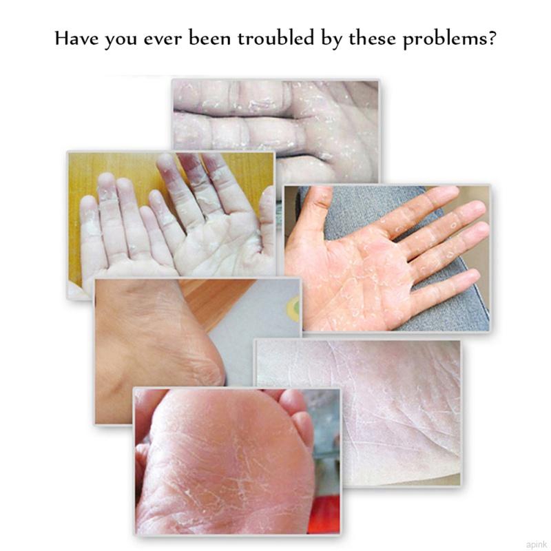 Cracked Heel Cream For Rough Dry Cracked Chapped Feet Remove Dead Skin Foot Care | BigBuy360 - bigbuy360.vn