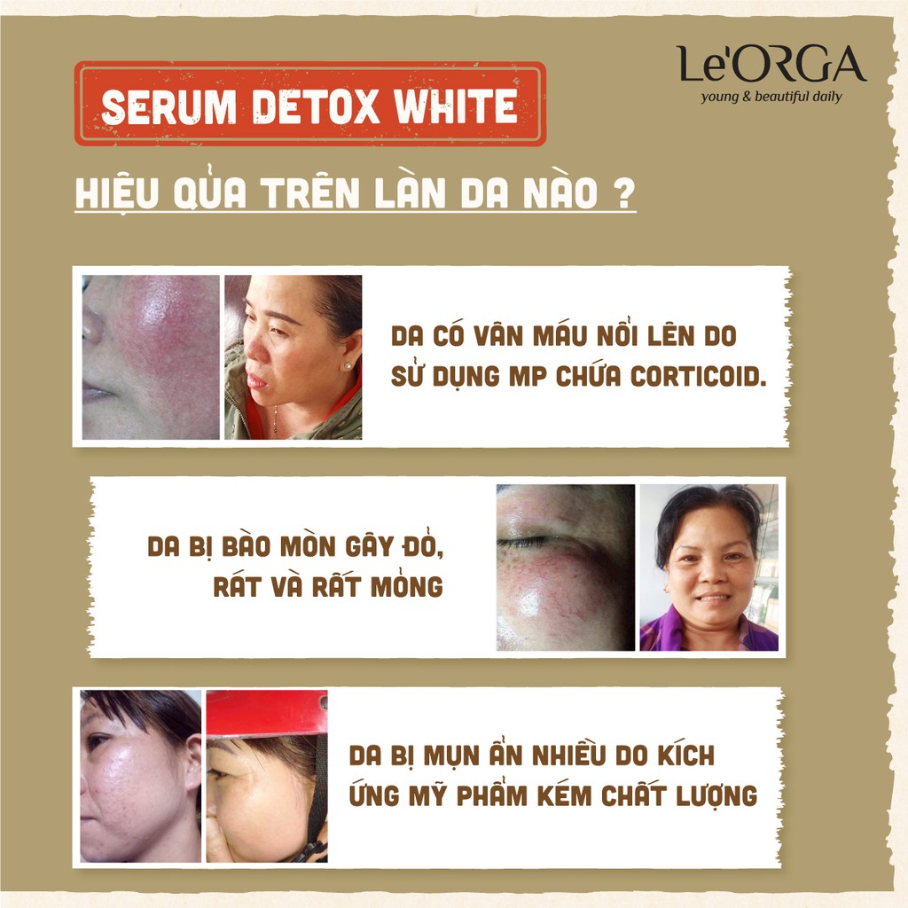 Serum Trắng Da Mờ Nám Le'Orga - Detox White Tinh Chất Trẻ Hóa Da Tăng Độ Ẩm Huyết Thanh Giảm Lão Hóa | BigBuy360 - bigbuy360.vn