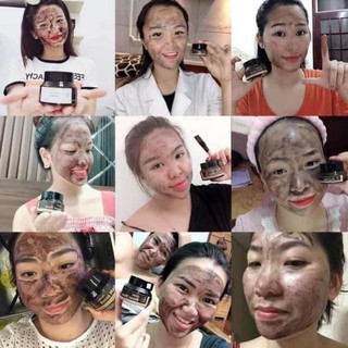 MẶT NẠ THẢI ĐỘC - DETOX MASK