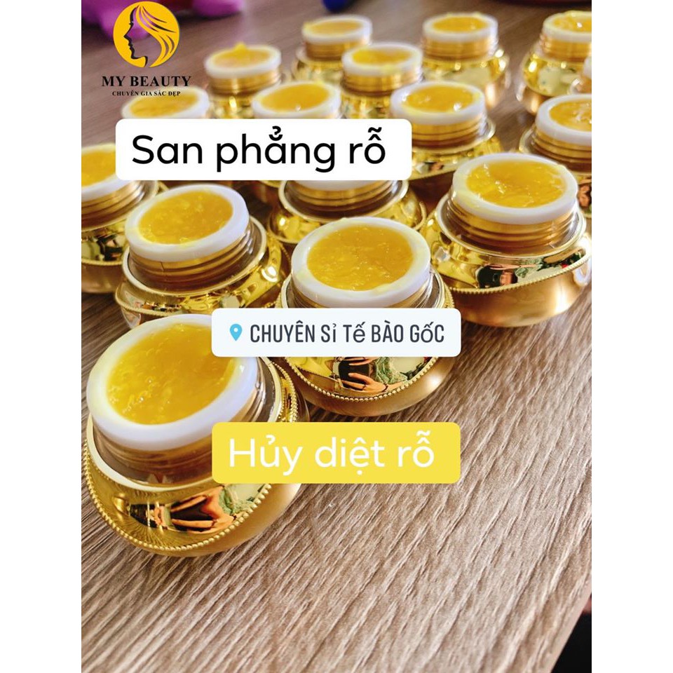Gel Ủ Rỗ Kích đầy sẹo rỗ | BigBuy360 - bigbuy360.vn