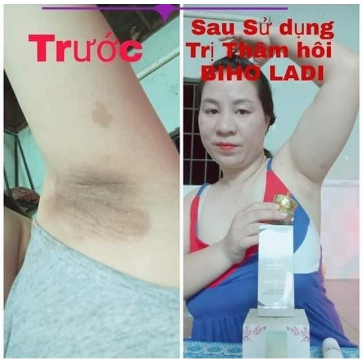 BIHO LADI Siêu Dưỡng Thâm 5S, Kem Làm Mờ Vết Thâm Nách, Mông, Bikini, Bẹn, Nhũ Hoa (Biho Lady, Biholadi Khử Mùi Cơ Thể) | BigBuy360 - bigbuy360.vn