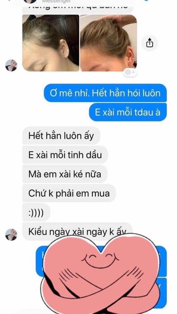 Xịt bưởi nga hoàng trị rụng tóc , kích thích mọc tóc | BigBuy360 - bigbuy360.vn