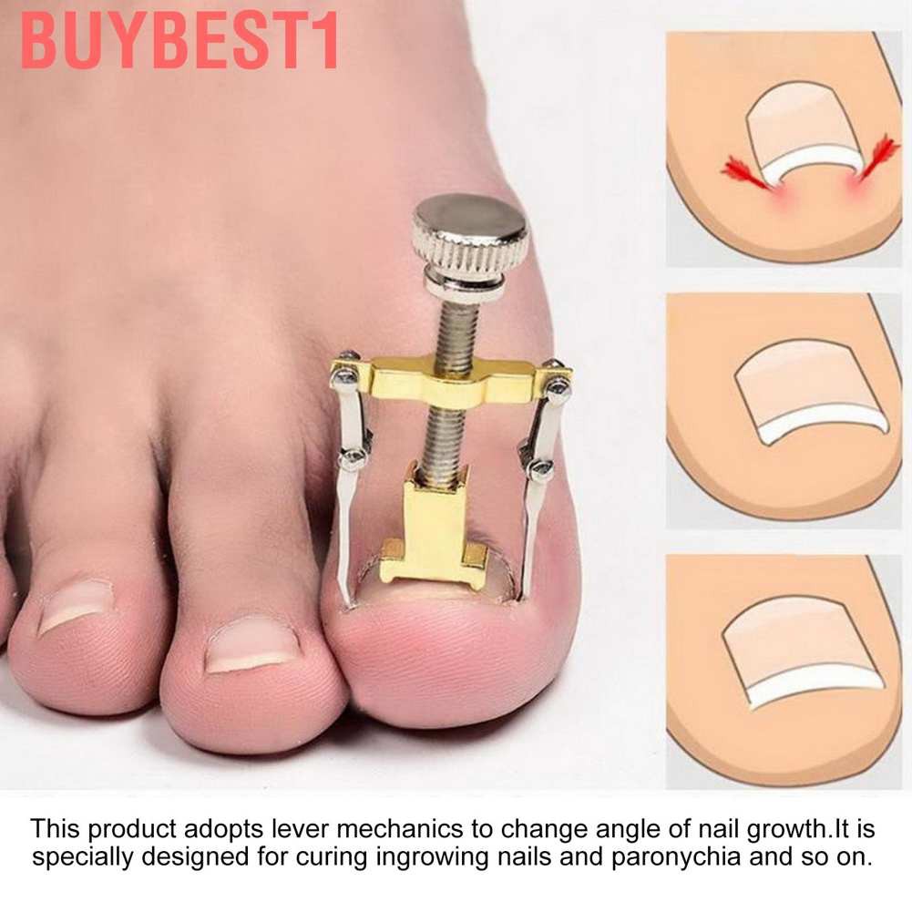 (Hàng Mới Về) Set 13 Miếng Dán Chỉnh Hình Móng Chân Tiện Dụng | BigBuy360 - bigbuy360.vn