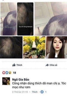 TINH DẦU KÍCH THÍCH MỌC TÓC MAHAAD THÁI LAN(1 chai)