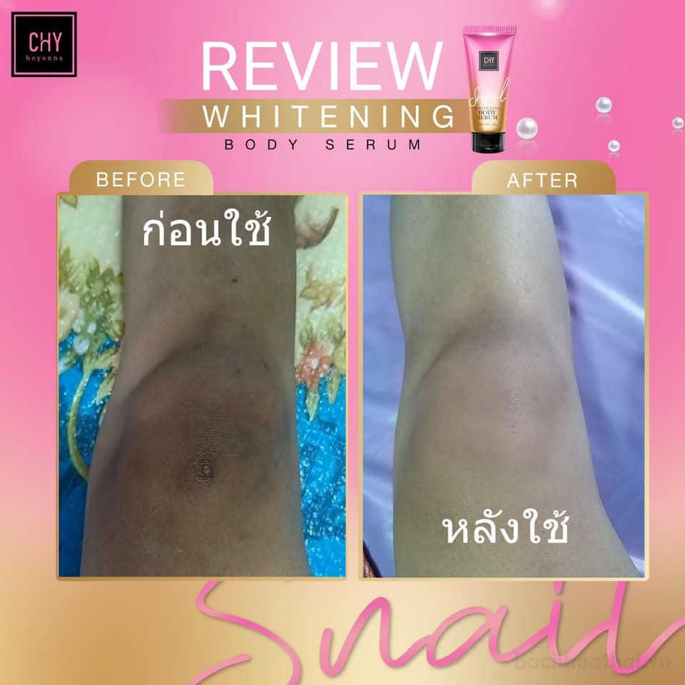 Serum ƙích trắŉg body tınh chấţ ốc sêņ CHY Snaıl whitening body serum Thái Lan