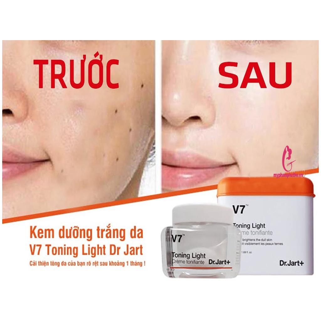 Kem Dưỡng V7 Phục Hồi Da 50ml, Kem V7 Dưỡng Trắng Tái Tạo Da Toning Light Dr.Jar [Hàn Quốc] - Giúp Da Khoẻ Mạnh