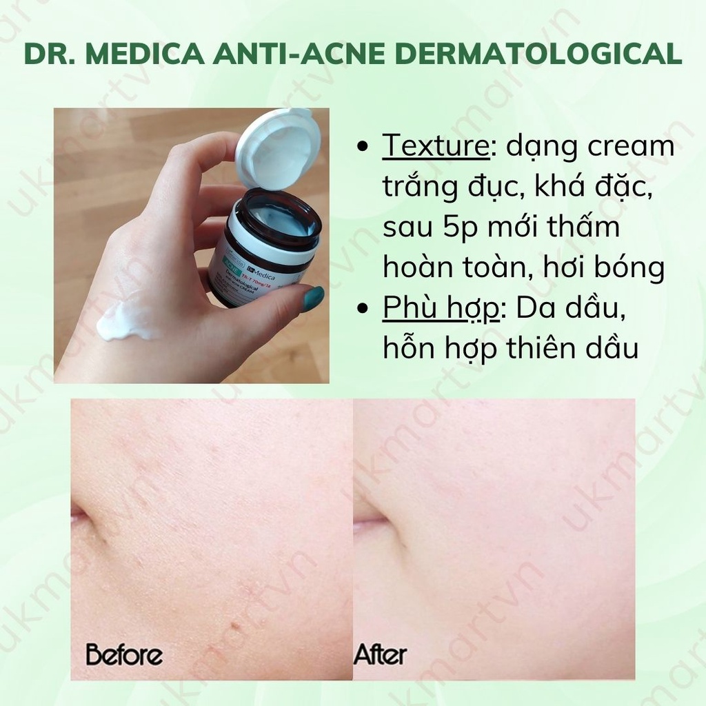 Kem Dưỡng Da Dầu Mụn Bielenda Dr Medica Dermatological Anti Acne Face Cream Day Night 50ml