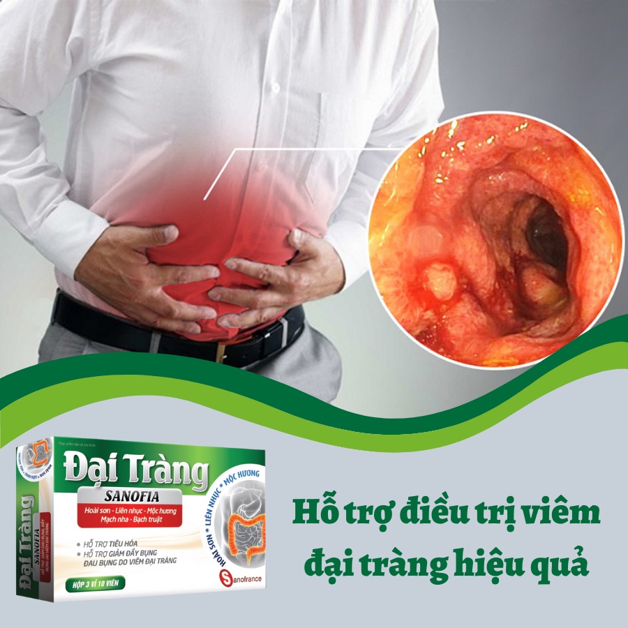 Viên uống Đại tràng Sanofia hỗ trợ giúp giảm các triệu chứng của viêm đại tràng Hộp 30 viên - NT325