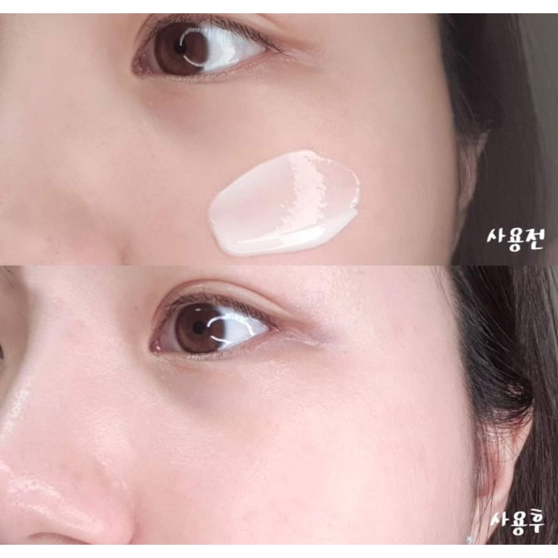 Kem dưỡng A’PIEU MADECASSOSIDE