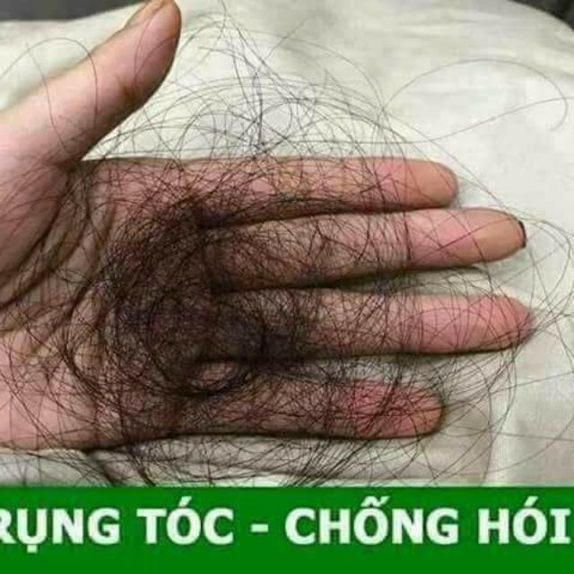 TINH DẦU BƯỞI TRỊ RỤNG TÓC