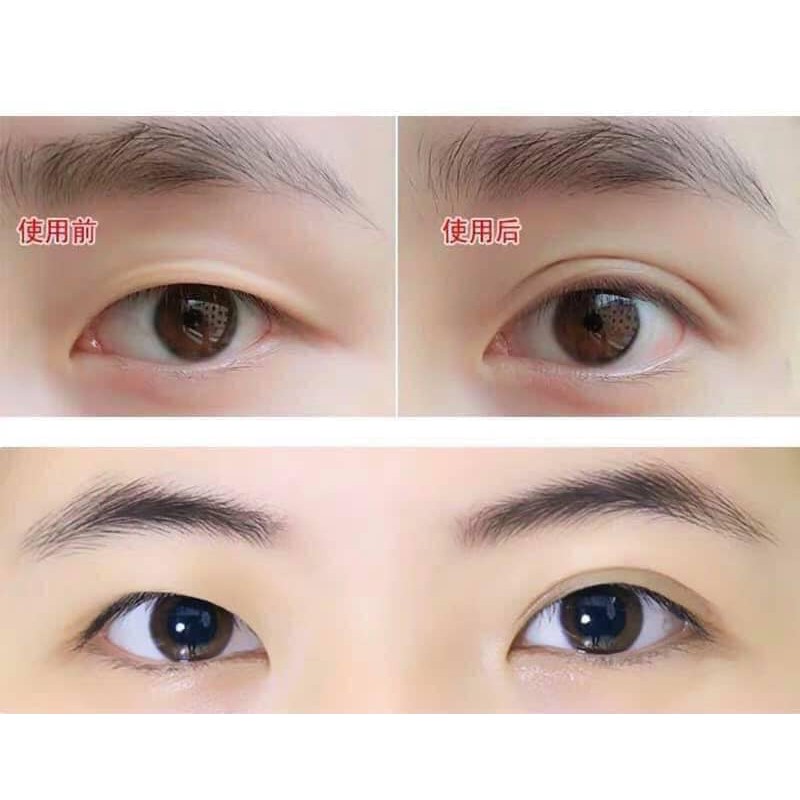 Keo kích mí Sanuo 25g