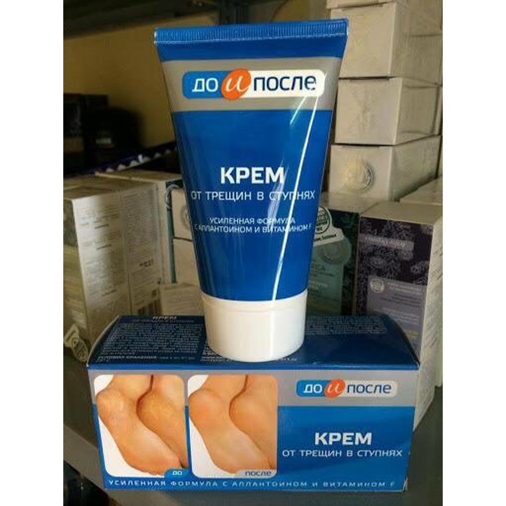 Kem Ngăn Ngừa Và Hồi Phục Nứt Nẻ Gót Chân Kpem Nga 50ml