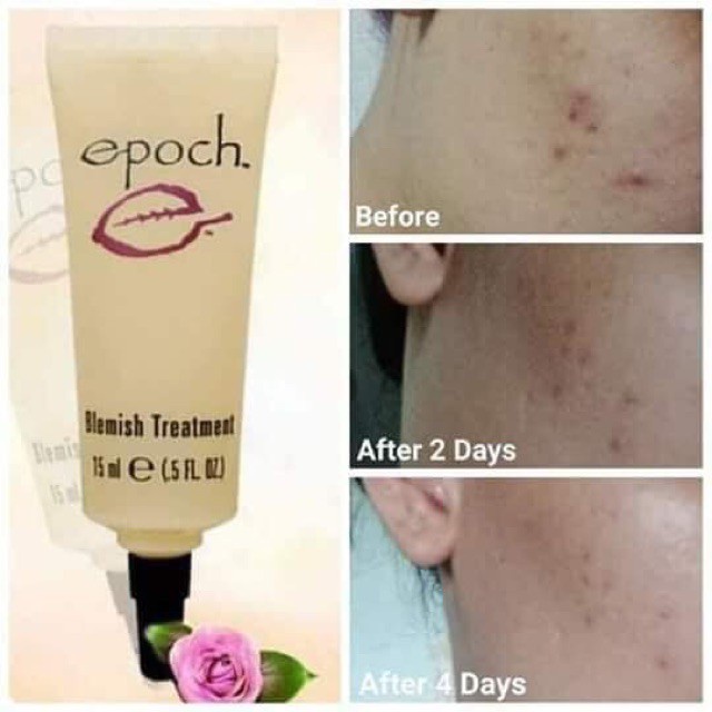 Kem Chấm Mụn Nuskin Epoch Blemish Treatment 15ml