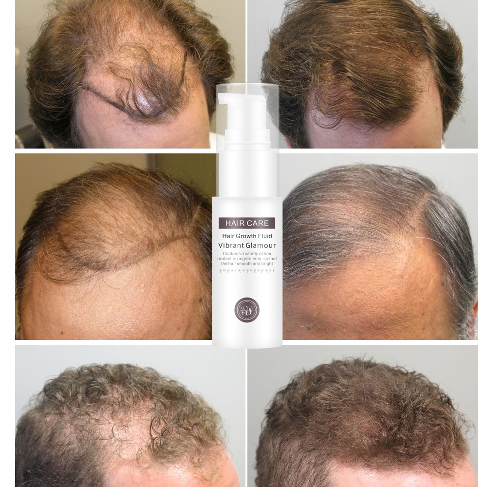 Tinh chất xịt VIBRANT GLAMOUR ngăn rụng tóc 30ml | BigBuy360 - bigbuy360.vn