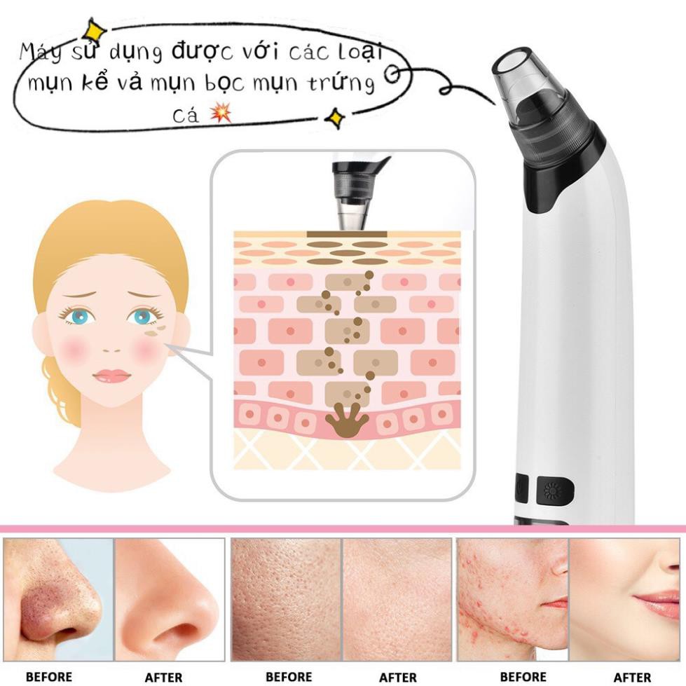 [sỉ] Máy Hút Mụn | BLACKHEAD | Máy Hút Mụn Đầu Đen | Có Chế Độ Masage | Thế Giới Skin Care