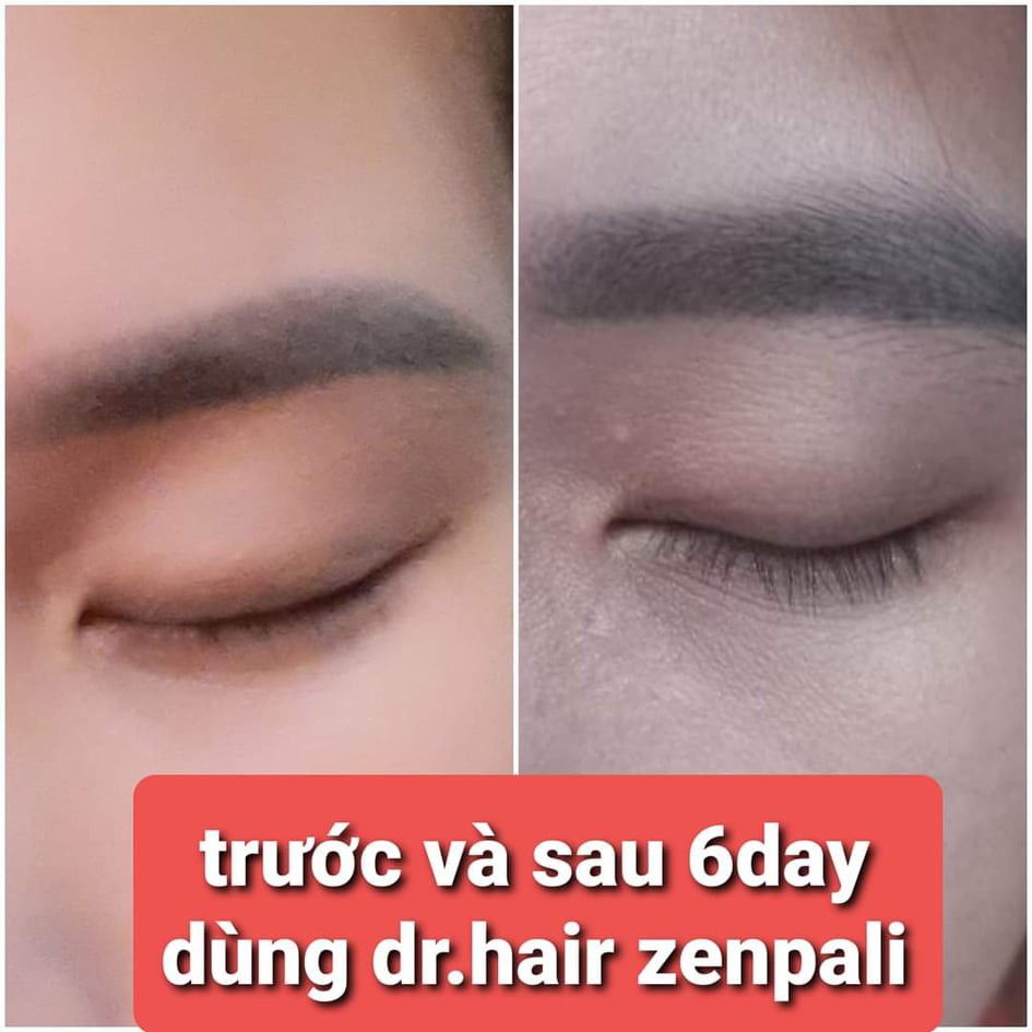 Dr.Hair Zenpali Dài Mi, Dầy Mày, Kích Mọc Tóc | BigBuy360 - bigbuy360.vn