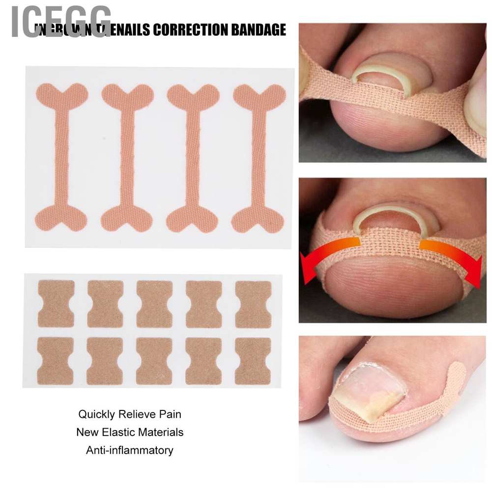 (Hàng Mới Về) Set 13 Dụng Cụ Chỉnh Hình Móng Chân Mọc Ngược Tiện Dụng | BigBuy360 - bigbuy360.vn