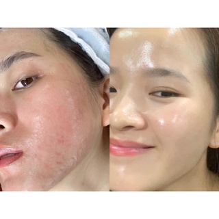 MẶT NẠ B5 PHỤC HỒI LÀM DỊU DA CẤP TỐC ( Bản dupe Smas)