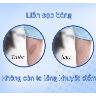 kem sẹo nga klirvin mờ thâm mụn mờ sẹo lồi sẹo lõm sẹo rỗ ngừa mụn rạn da giảm thâm mắt [𝐓𝐚̣̆𝐧𝐠 𝐦𝐚́𝐲 𝐦𝐚𝐬𝐬𝐚𝐠𝐞𝐫 𝐦𝐚̣̆𝐭]