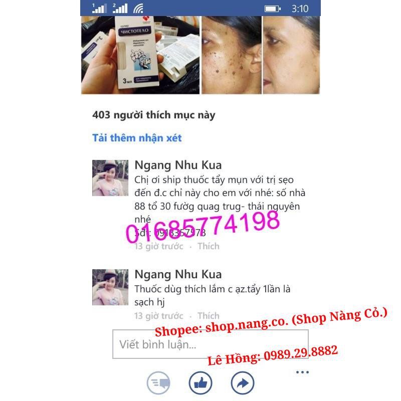 [Chính Hãng] Loại 3ml GEL TẨY NỐT RUỒI, MỤN CƠM, MỤN CÓC, SẸO LỒI, THỊT THỪA - Dvelinil nhập khẩu Nga Hiệu quả Tốt | BigBuy360 - bigbuy360.vn