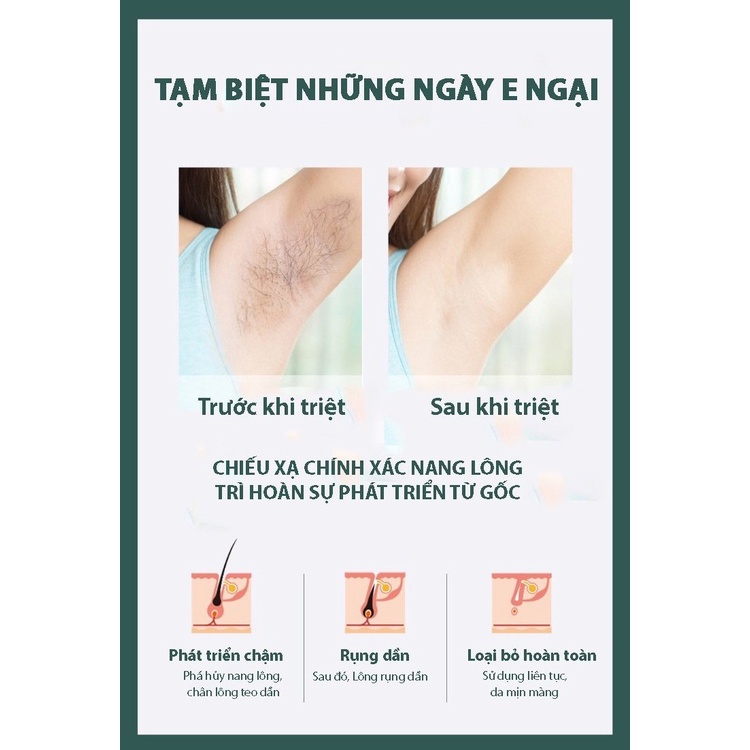 Máy triệt lông cầm tay công nghệ mới FINOSE TL01 – Triệt lông nách / Tay / Chân/ Vùng kín/ Mặt – Se khít lỗ chân lông.