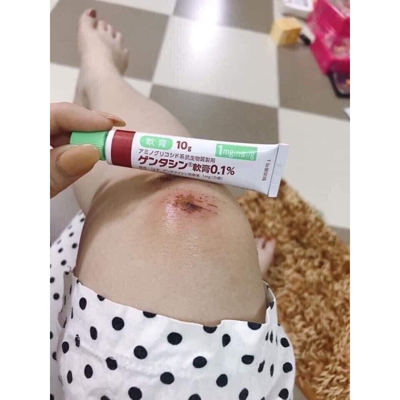 [CHÍNH HÃNG] KEM SẸO GENTACIN NHẬT BẢN | BigBuy360 - bigbuy360.vn
