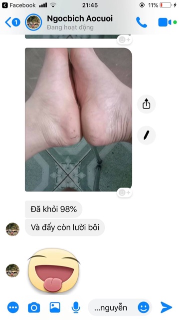 [CỰC HIỆU QUẢ] Bôi Hỗ Trợ Á Sừng Tổ Đỉa Nấm Nứt Gót Chân Hắc Lào | BigBuy360 - bigbuy360.vn