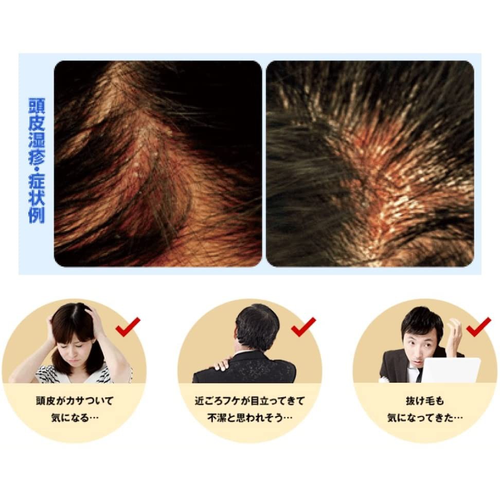 Hàng nhật/ Dầu gội Ro.ht.o - Mediquick H /dành cho ngứa da đầu, nấm Hương cam quýt