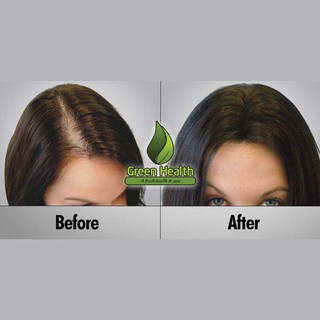 Serum mọc tóc, chân mày cho nữ Equate Minoxidil 2%