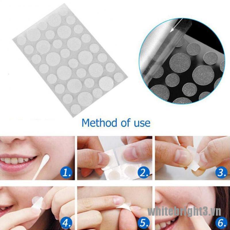 Set 36 Kem Hỗ trợ giảm mụn Hiệu Quả Chăm Sóc Da