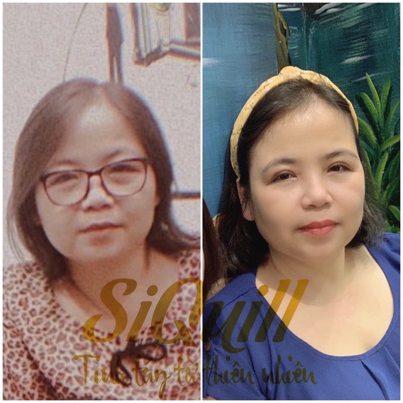 Xịt Mọc Tóc Tinh Dầu Bưởi Siquill ⚡𝑪𝒉𝒊́𝒏𝒉 𝑯𝒂̃𝒏𝒈 100%⚡ Mọc tóc nhanh giảm tình trạng hói sản phẩm thiên nhiên 100 | BigBuy360 - bigbuy360.vn