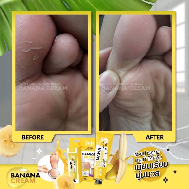 Kem Giảm Nứt Gót Bàn Chân Banana Cream Feet and Heels 50g