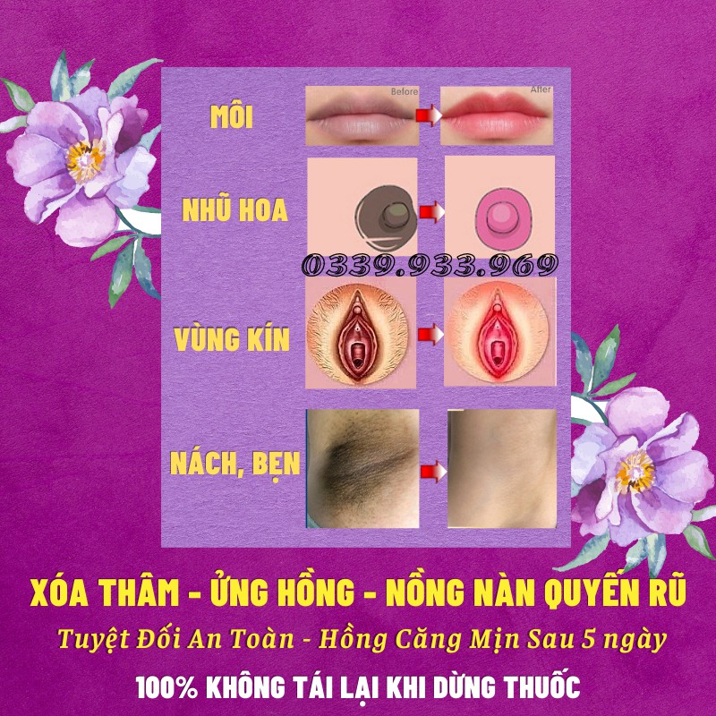 Kem Chống Thâm Môi - Làm Hồng Môi - Nhũ Hoa - Vùng Kín Sexy Pink Aichun Beauty 30g | BigBuy360 - bigbuy360.vn