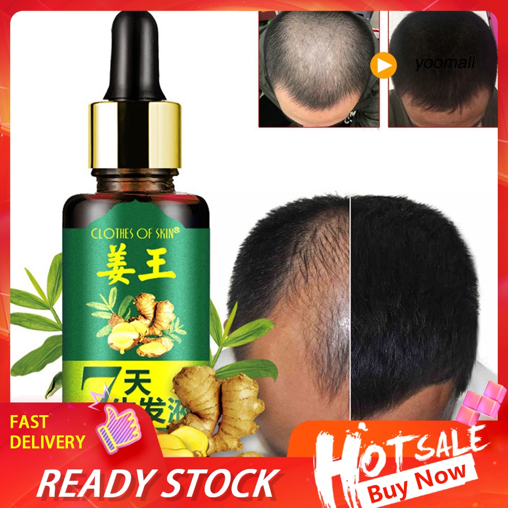 [Hàng mới về] Tinh Dầu Gừng Nuôi Dưỡng Kích Thích Mọc Tóc Trong 7 Ngày