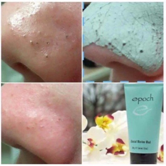 Mặt nạ bùn khoáng Nuskin Epoch Glacial Marine Mud (chính hãng Mỹ 100 %)