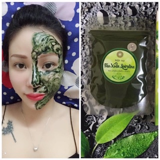 Tảo xoắn phi kim