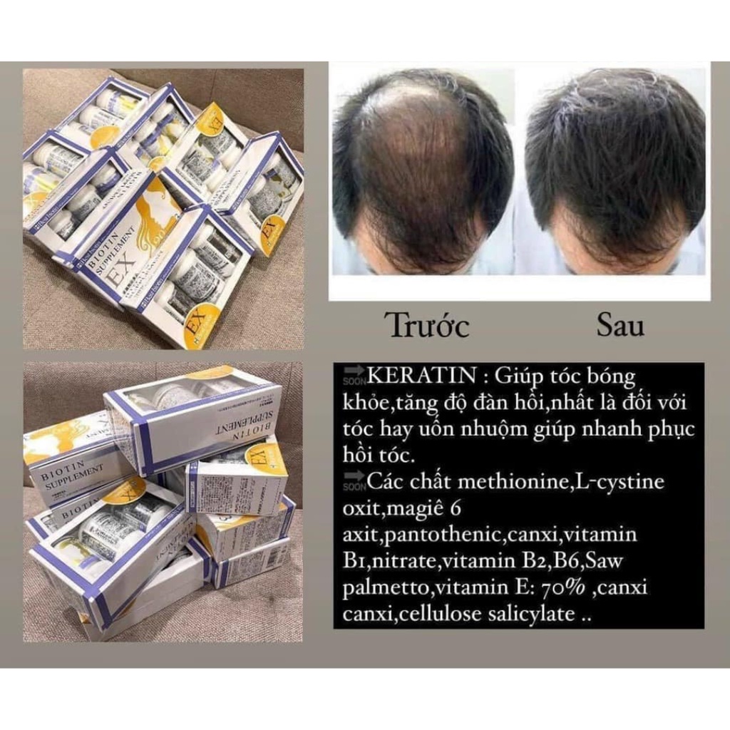 Best Biotin Supplement EX - Viên Uống Giúp Mọc Tóc Nhật Bản - 90 Viên