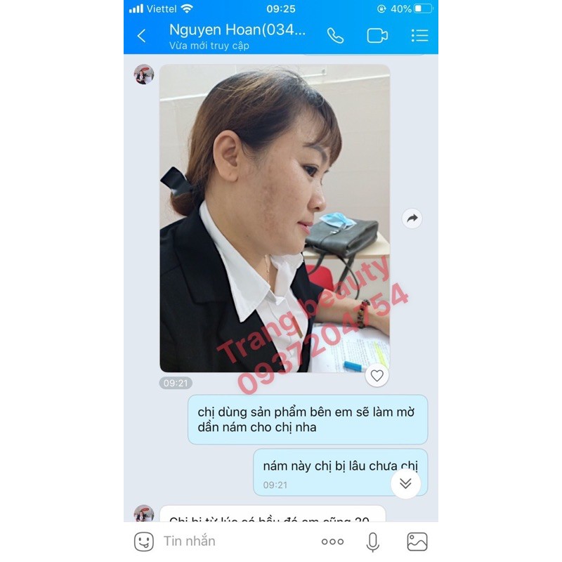 [chính hãng 100%] viên sủi trắng da NeuGlow uka | BigBuy360 - bigbuy360.vn