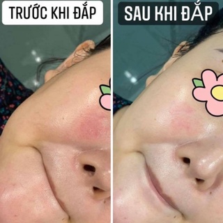 Mặt Nạ Smas Peptide Silk Mask Phục Hồi Cấp Ẩm Cấp Tốc