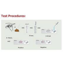 Que test bệnh Giảm bạch cầu (FPV)