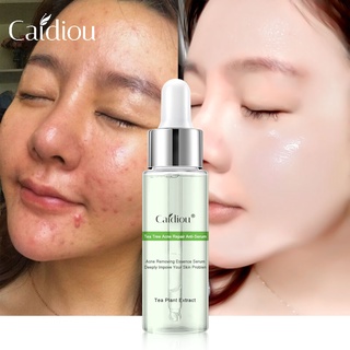 [Hàng mới về] Serum CAIDIOU 15ml hỗ trợ giảm mụn trứng cá cho làn da trắng sáng
