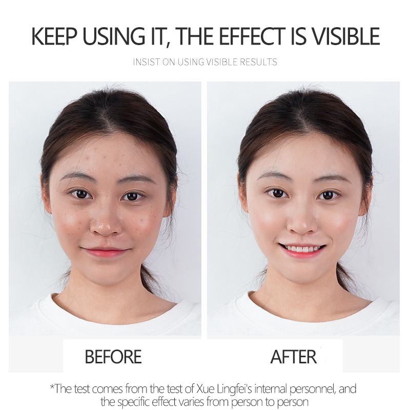 (Hàng Mới Về) Dung Dịch Trị Mụn Đầu Đen Kiềm Dầu Dưỡng Ẩm Thu Nhỏ Lỗ Chân Lông 125ml Snefe | BigBuy360 - bigbuy360.vn