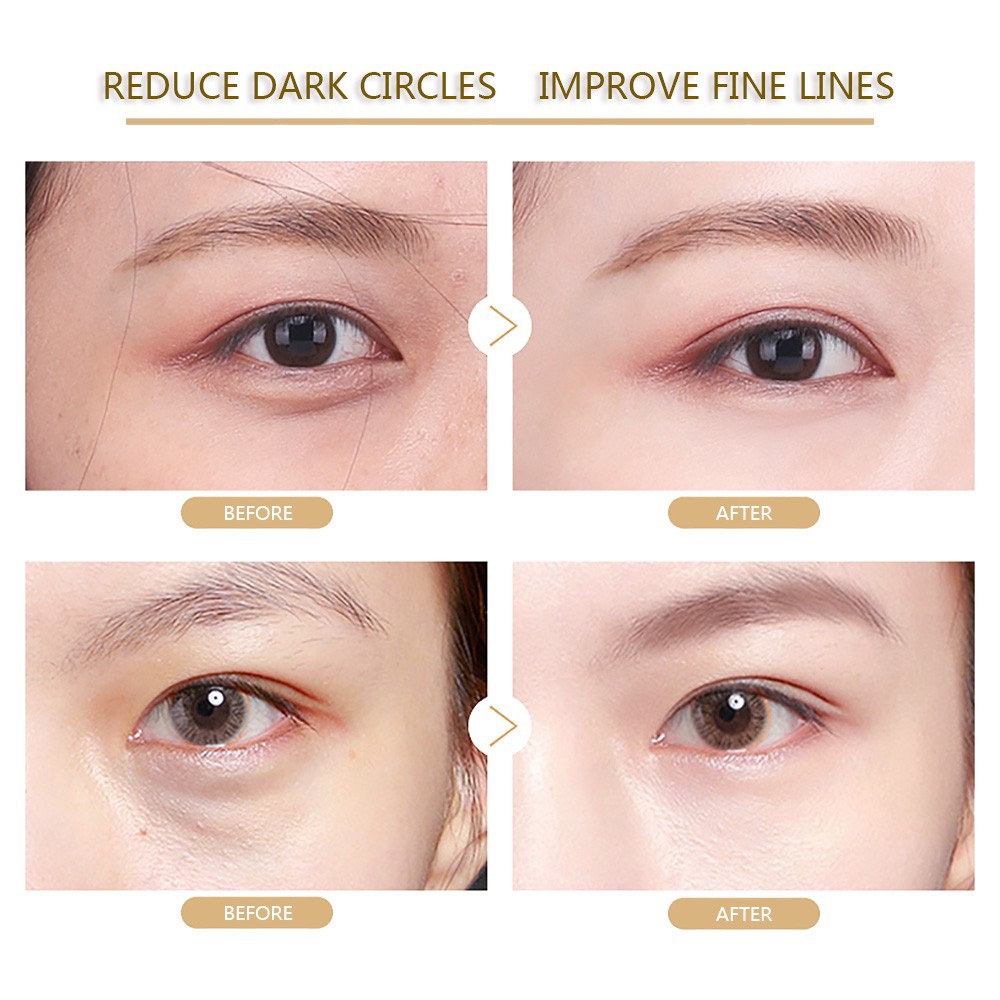 Mặt nạ mắt collagen nạ mắt collagen crystal eyelid patch 1 miếng | BigBuy360 - bigbuy360.vn