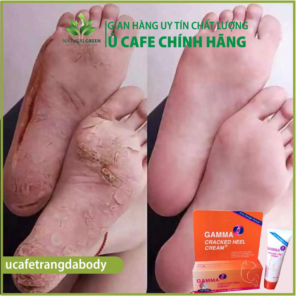 Kem giảm nứt gót chân, khô nứt da Gamma Cracked Heel sản phẩm chuyên dùng cho da khô nứt nẻ cho kết quả cực kỳ tốt. ...